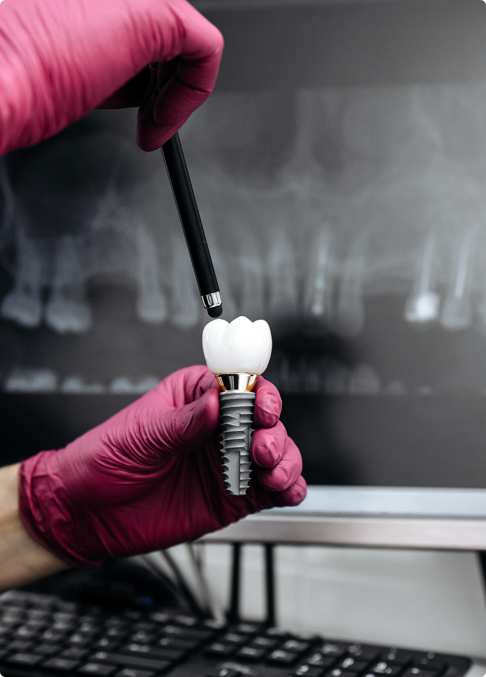 Implant dentaire