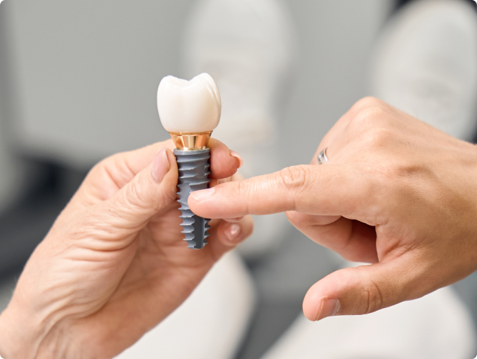 Implant dentaire